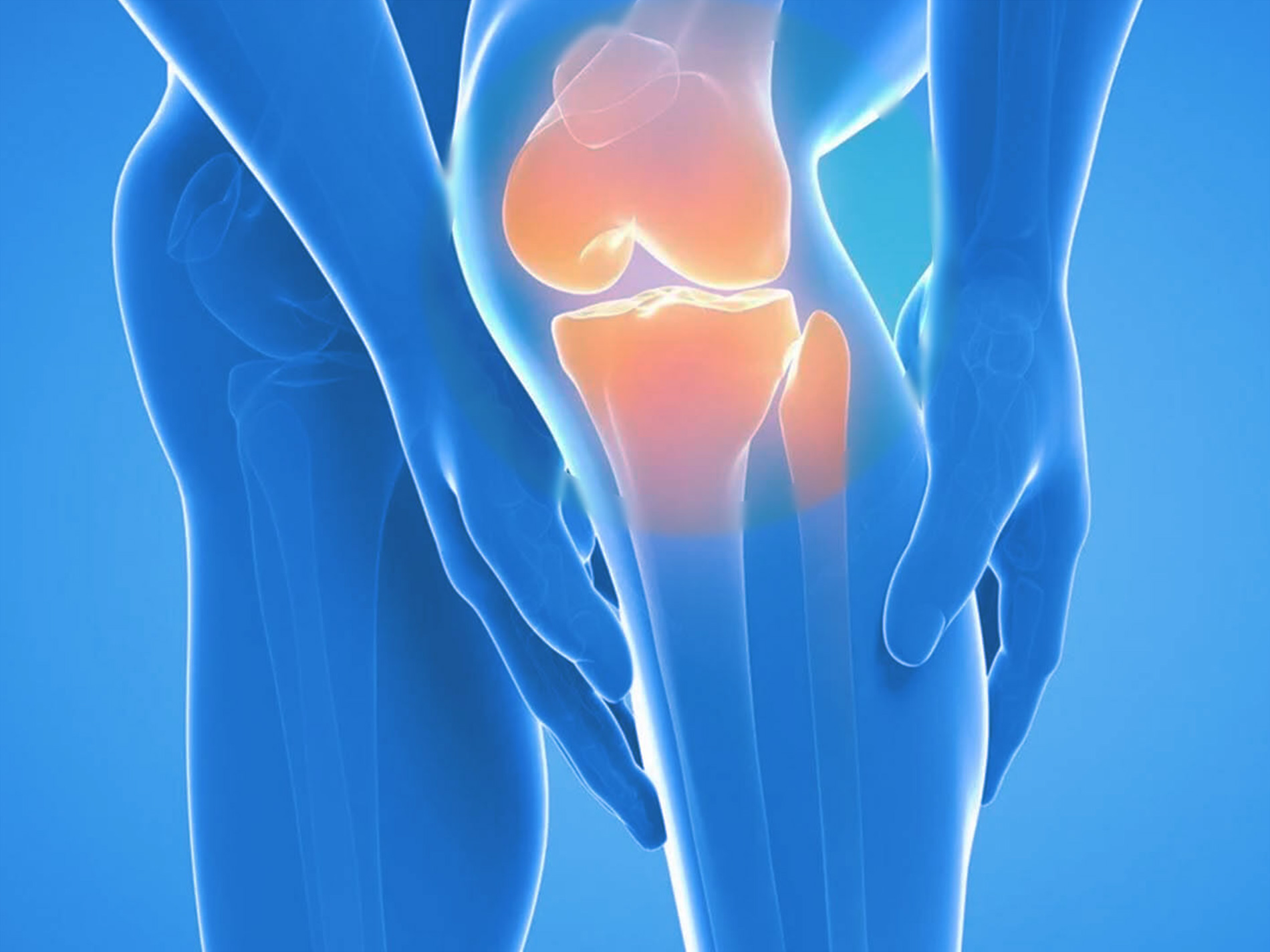 Ноющая боль в коленном. Пателлофеморальный артроз коленного сустава рентген. Дисплазия пателлофеморального сустава колена. Здоровые суставы.